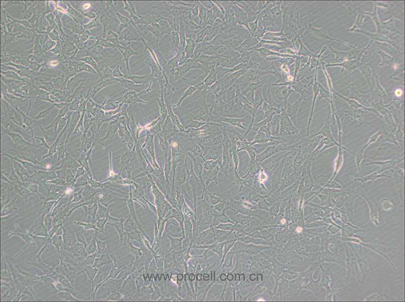 KHM-5M (人甲狀腺癌細胞(未分化)) (STR鑒定正確)