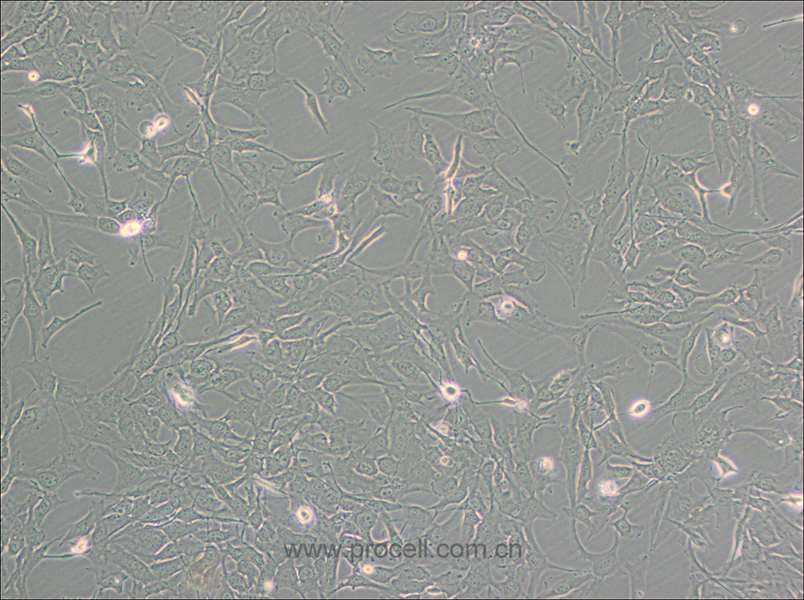 KHM-5M (人甲狀腺癌細胞(未分化)) (STR鑒定正確)