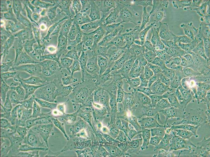 KHM-5M (人甲狀腺癌細胞(未分化)) (STR鑒定正確)