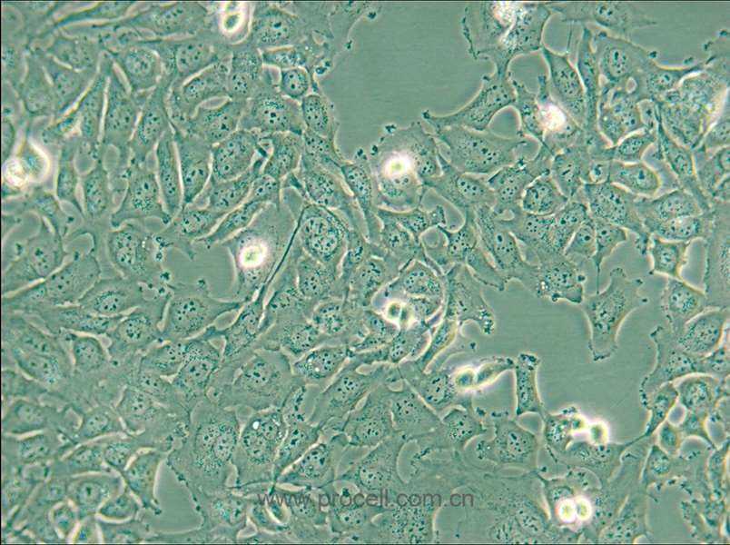 KHM-5M (人甲狀腺癌細胞(未分化)) (STR鑒定正確)