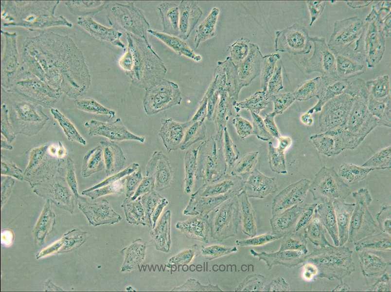 TCCSUP (人膀胱癌細胞) (STR鑒定正確)