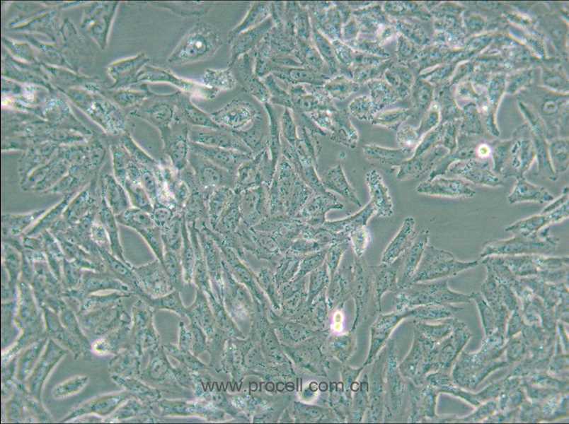 NCI-H647 (人肺癌細(xì)胞) (STR鑒定正確)