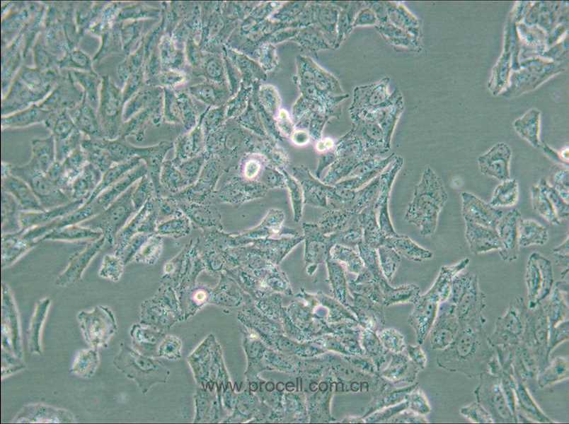 NCI-H647 (人肺癌細(xì)胞) (STR鑒定正確)