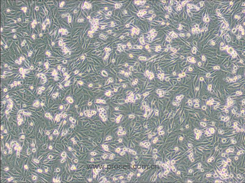 MDA-MB-231-GFP (人乳腺癌細(xì)胞(綠色熒光蛋白標(biāo)記) (STR鑒定正確)