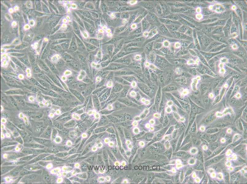 MDA-MB-231/GFP (人乳腺癌細(xì)胞(綠色熒光蛋白標(biāo)記) (STR鑒定正確)