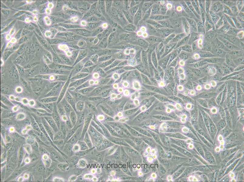 MDA-MB-231/GFP (人乳腺癌細(xì)胞(綠色熒光蛋白標(biāo)記) (STR鑒定正確)