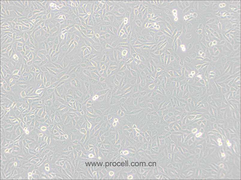 TPC-1 (人甲狀腺癌細胞) (STR鑒定正確)