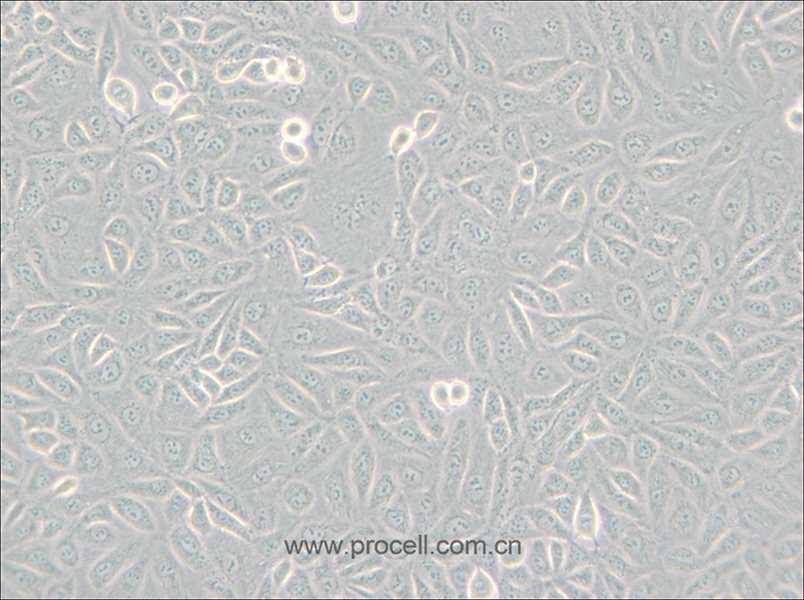 TPC-1 (人甲狀腺癌細胞) (STR鑒定正確)