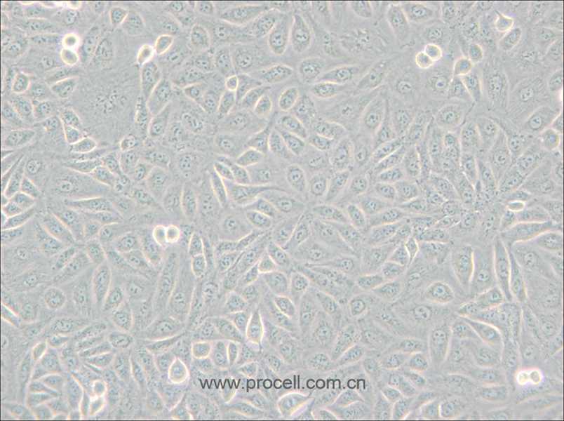 TPC-1 (人甲狀腺癌細胞) (STR鑒定正確)