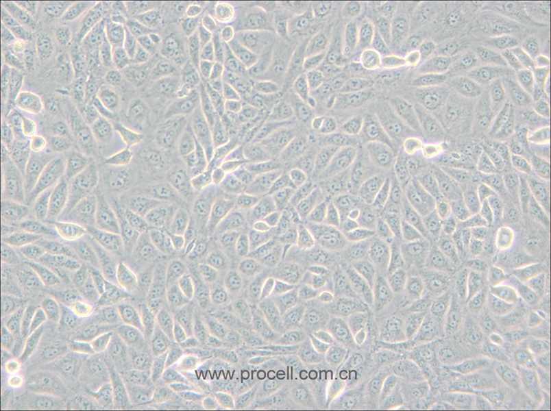 TPC-1 (人甲狀腺癌細胞) (STR鑒定正確)