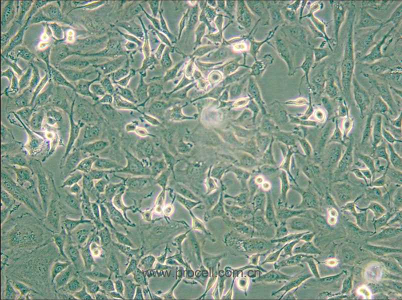 KTC-1 (人甲狀腺癌細(xì)胞) (STR鑒定正確)