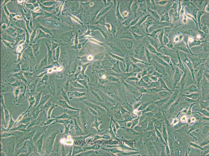 KTC-1 (人甲狀腺癌細(xì)胞) (STR鑒定正確)