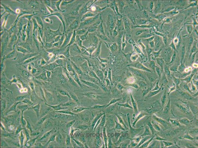 KTC-1 (人甲狀腺癌細(xì)胞) (STR鑒定正確)