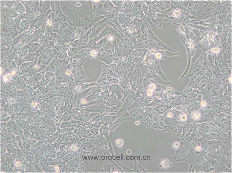 TTA1 (人甲狀腺癌細(xì)胞) (STR鑒定正確)