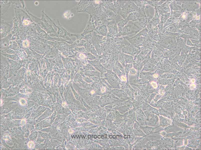 TTA1 (人甲狀腺癌細(xì)胞) (STR鑒定正確)