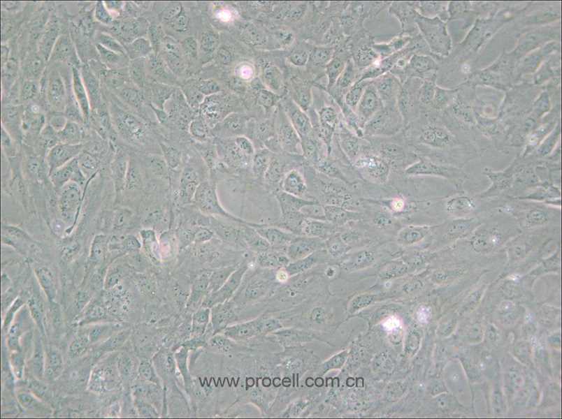 PUMC-HUVEC-T1 (SV40T轉(zhuǎn)化人臍靜脈內(nèi)皮細(xì)胞) (STR鑒定正確)