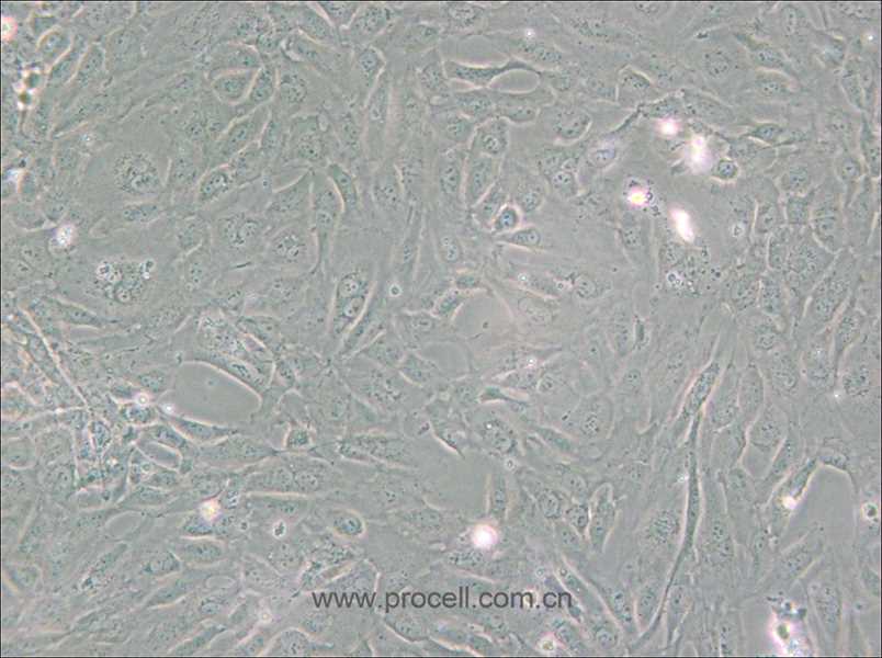 PUMC-HUVEC-T1 (SV40T轉(zhuǎn)化人臍靜脈內(nèi)皮細(xì)胞) (STR鑒定正確)