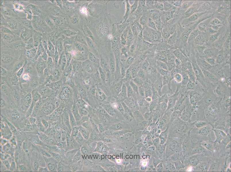 PUMC-HUVEC-T1 (SV40T轉(zhuǎn)化人臍靜脈內(nèi)皮細(xì)胞) (STR鑒定正確)