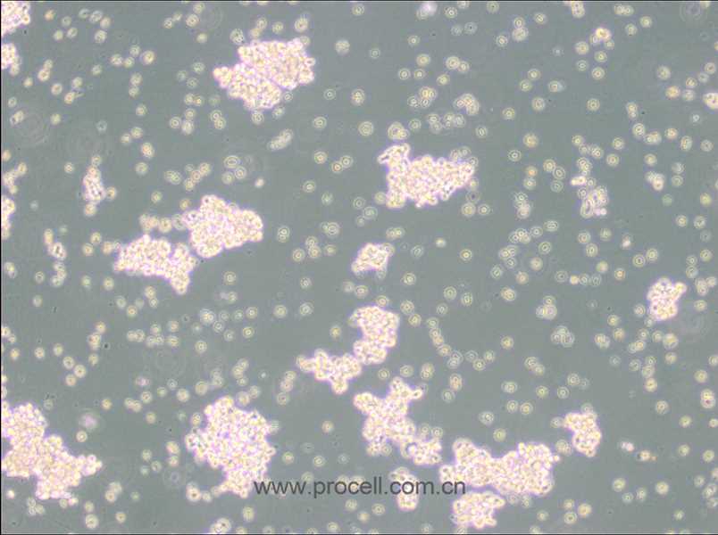 NCI-H69 (人小細胞肺癌細胞) (STR鑒定正確)