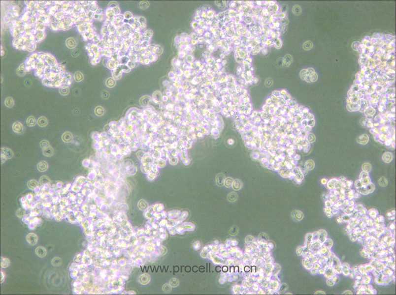 NCI-H69 (人小細胞肺癌細胞) (STR鑒定正確)