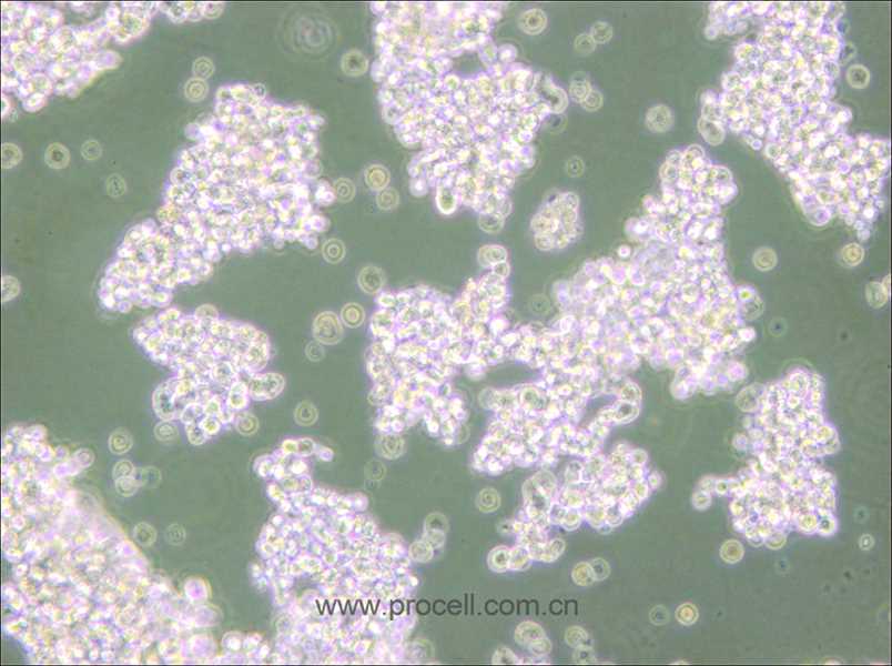 NCI-H69 (人小細胞肺癌細胞) (STR鑒定正確)