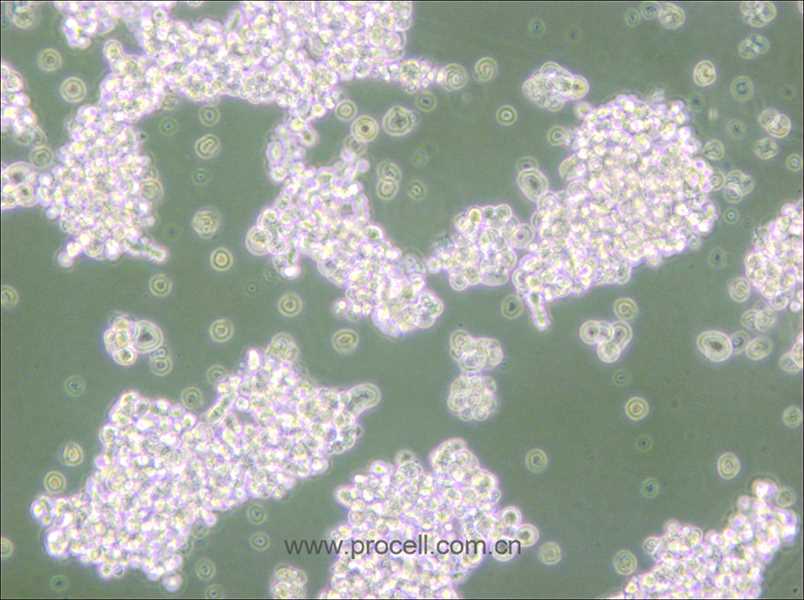 NCI-H69 (人小細胞肺癌細胞) (STR鑒定正確)