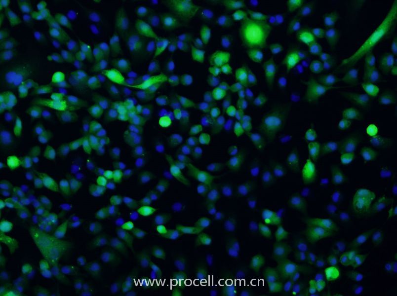 ACHN/GFP (人腎細(xì)胞腺癌細(xì)胞(綠色熒光標(biāo)記)) (STR鑒定正確)