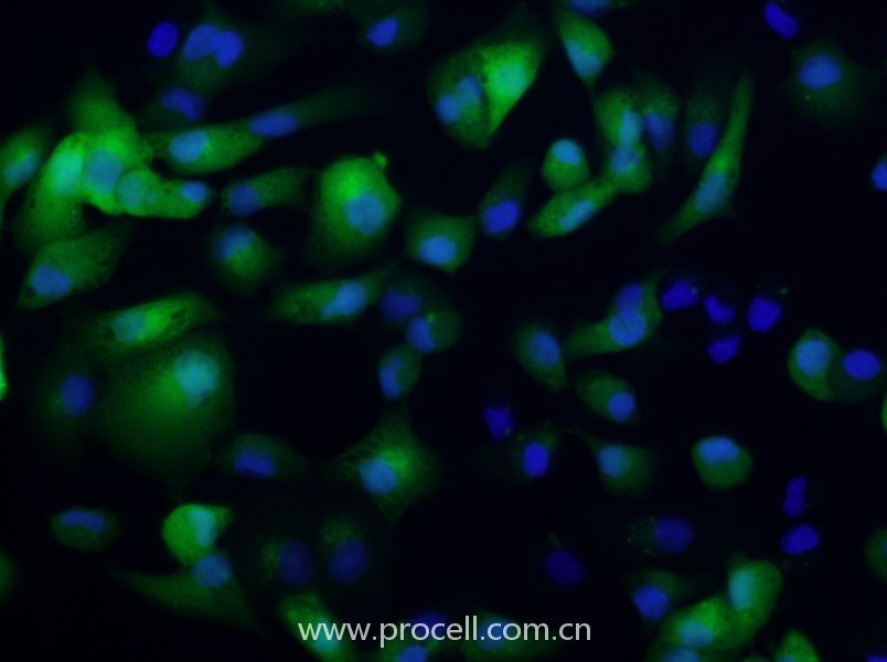 ACHN/GFP (人腎細(xì)胞腺癌細(xì)胞(綠色熒光標(biāo)記)) (STR鑒定正確)