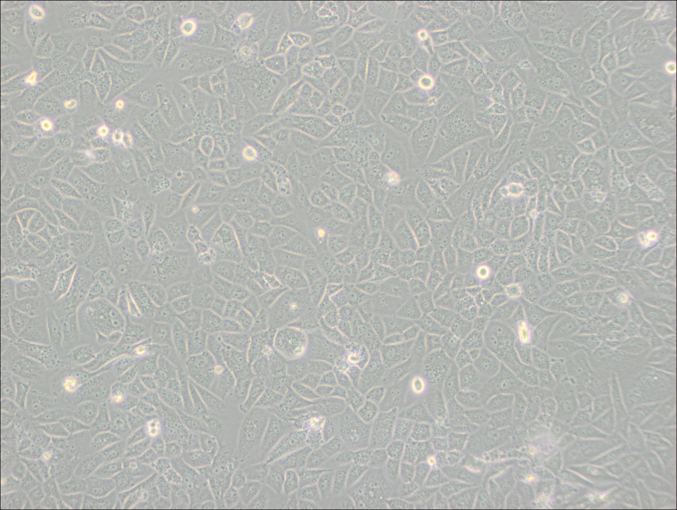 SK-LU-1 (人低分化肺腺癌細(xì)胞) (STR鑒定正確)