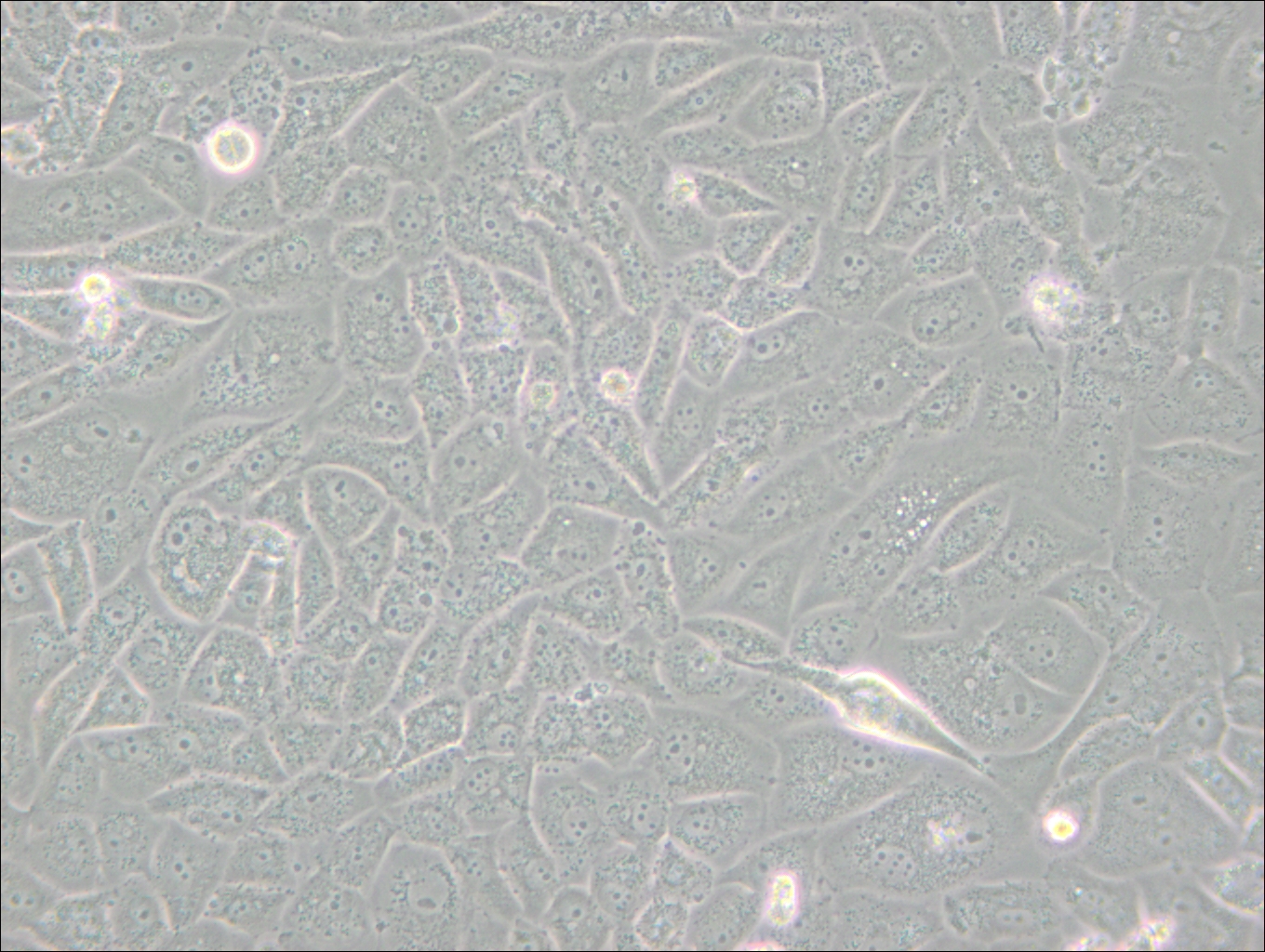 SK-LU-1 (人低分化肺腺癌細(xì)胞) (STR鑒定正確)