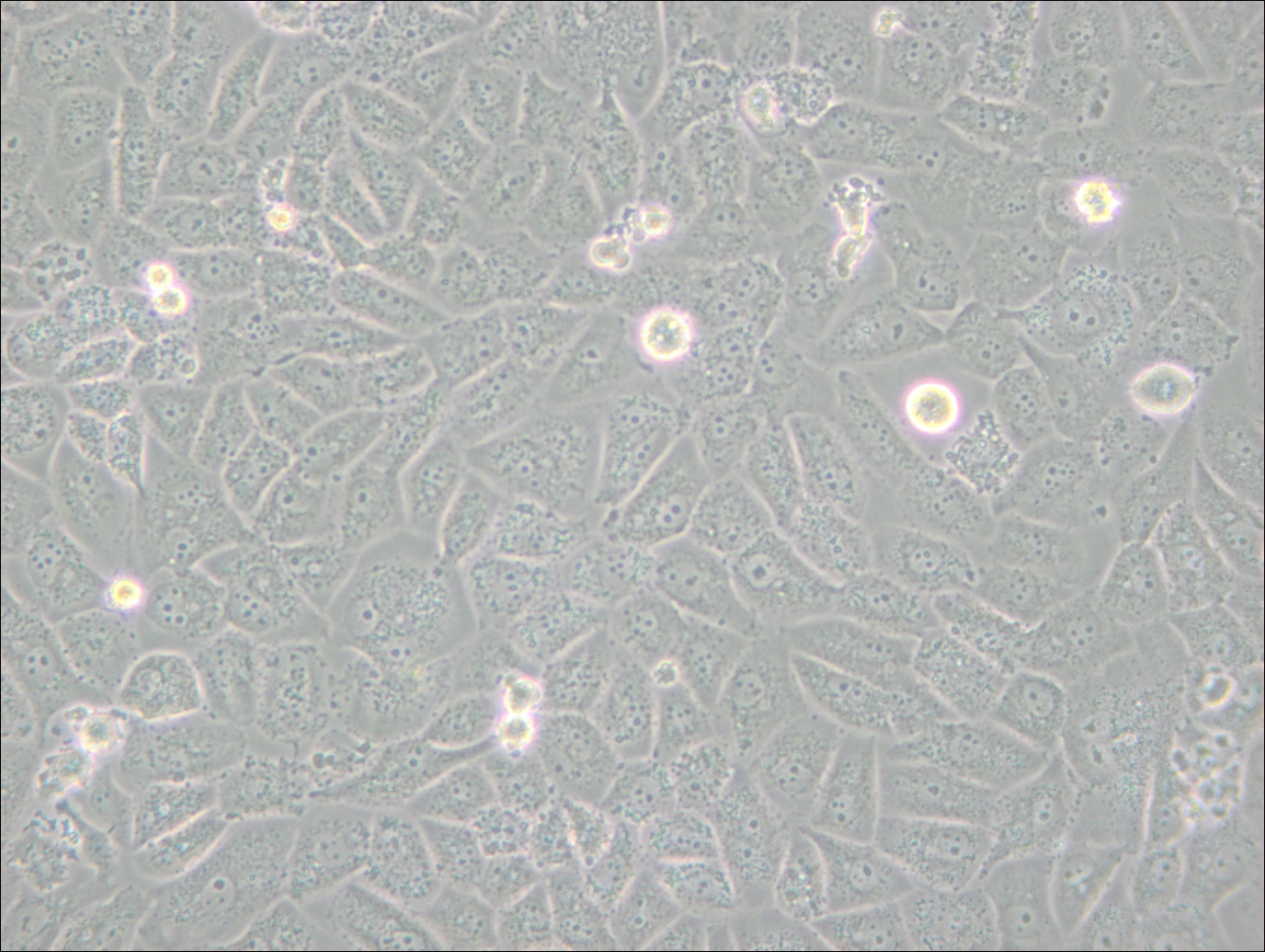 SK-LU-1 (人低分化肺腺癌細(xì)胞) (STR鑒定正確)