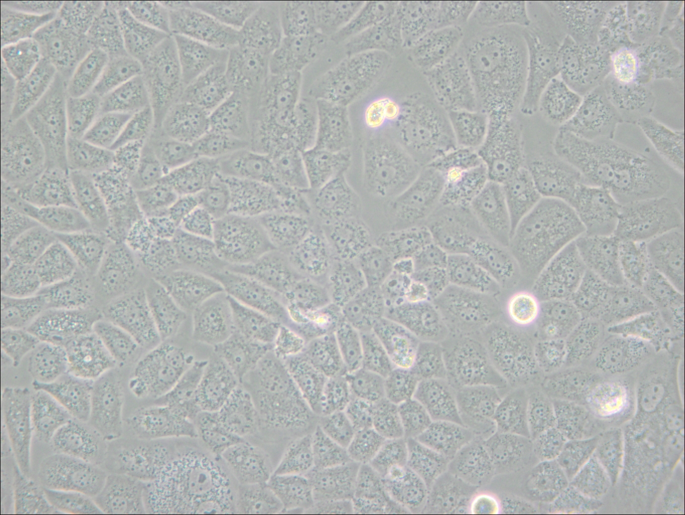 SK-LU-1 (人低分化肺腺癌細(xì)胞) (STR鑒定正確)