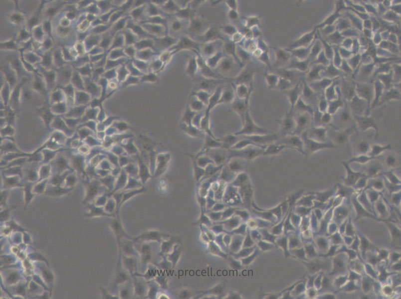 HCC1806 (人乳腺鱗狀癌細胞) (STR鑒定正確)