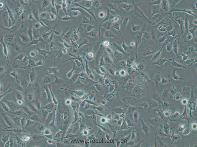 HBE135-E6E7 (人支氣管上皮細胞) (STR鑒定正確)