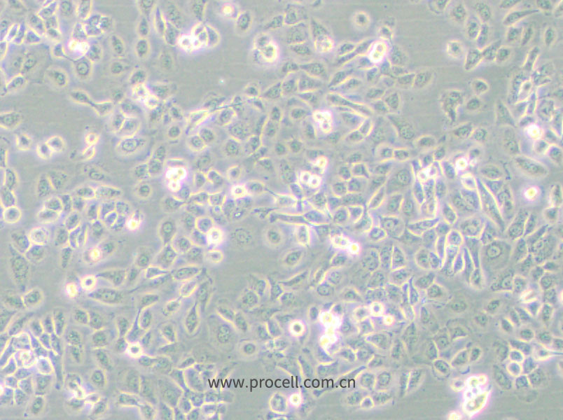 SUM149PT (人乳腺癌細(xì)胞) (STR鑒定正確)