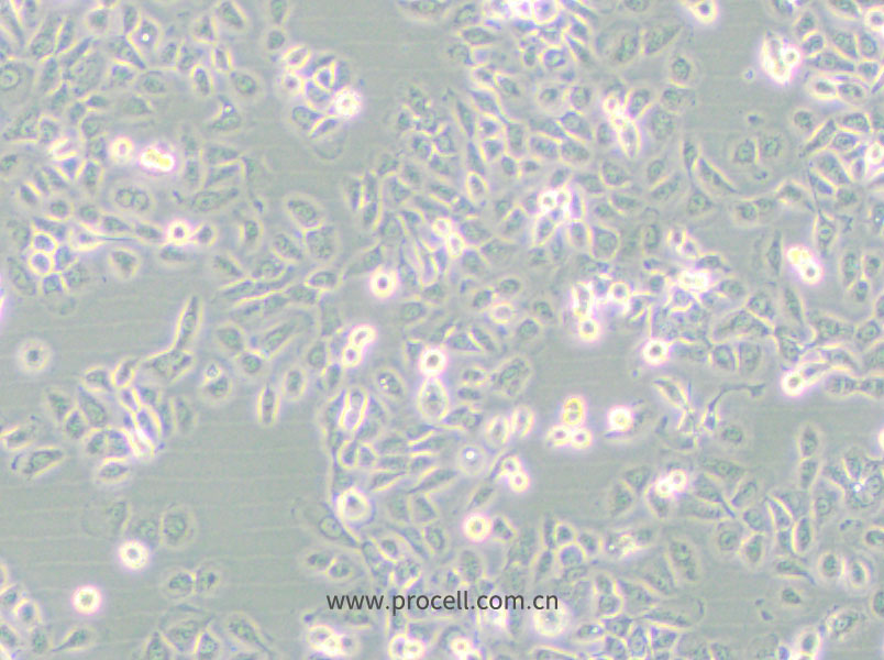 SUM149PT (人乳腺癌細(xì)胞) (STR鑒定正確)