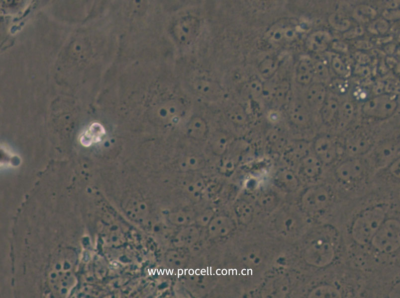 SW1463 (人大腸癌細(xì)胞) (STR鑒定正確)