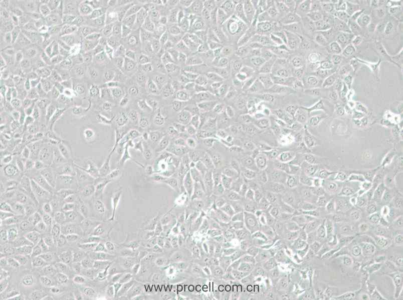 HCE-T (人角膜上皮細(xì)胞) (STR鑒定正確)