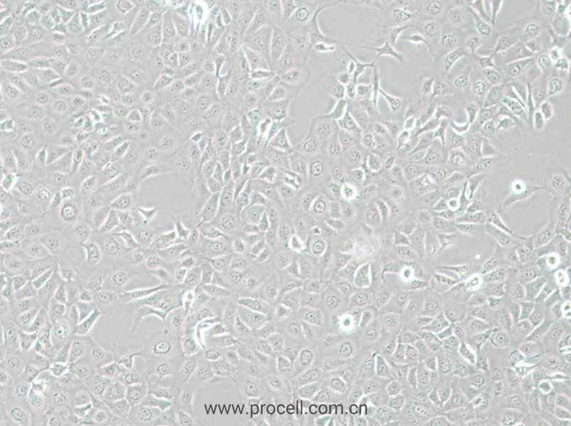 HCE-T (人角膜上皮細(xì)胞) (STR鑒定正確)