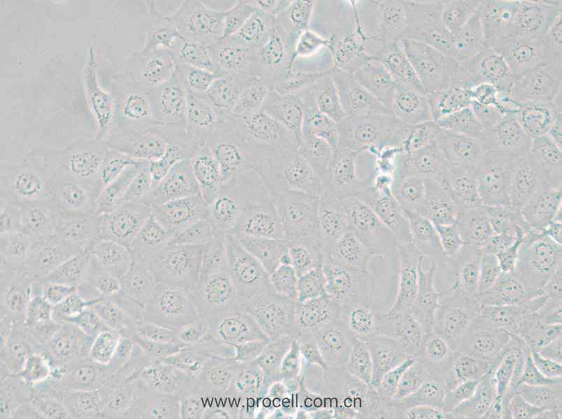 HCE-T (人角膜上皮細(xì)胞) (STR鑒定正確)