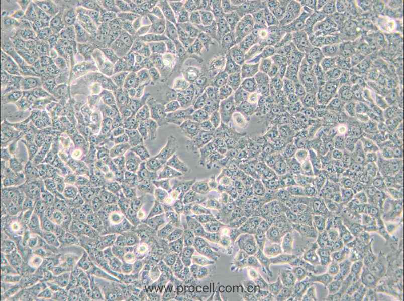 SN12C (人腎癌細(xì)胞) (STR鑒定正確)