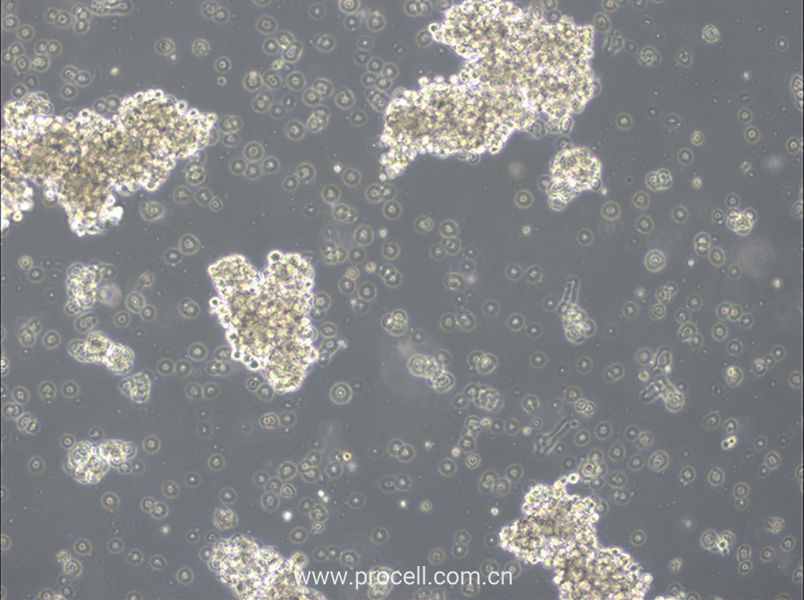 OCI-Ly3 (人彌漫大 B 細胞淋巴瘤細胞) (STR鑒定正確)