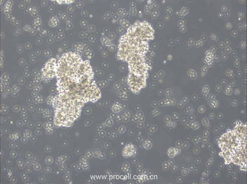 OCI-Ly3 (人彌漫大 B 細胞淋巴瘤細胞) (STR鑒定正確)