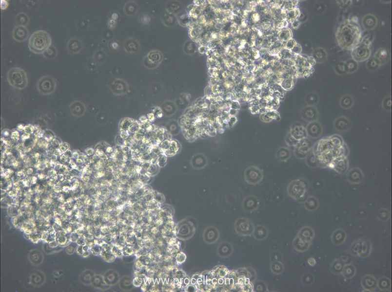 OCI-Ly3 (人彌漫大 B 細胞淋巴瘤細胞) (STR鑒定正確)