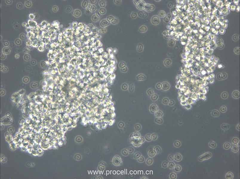 OCI-Ly3 (人彌漫大 B 細胞淋巴瘤細胞) (STR鑒定正確)