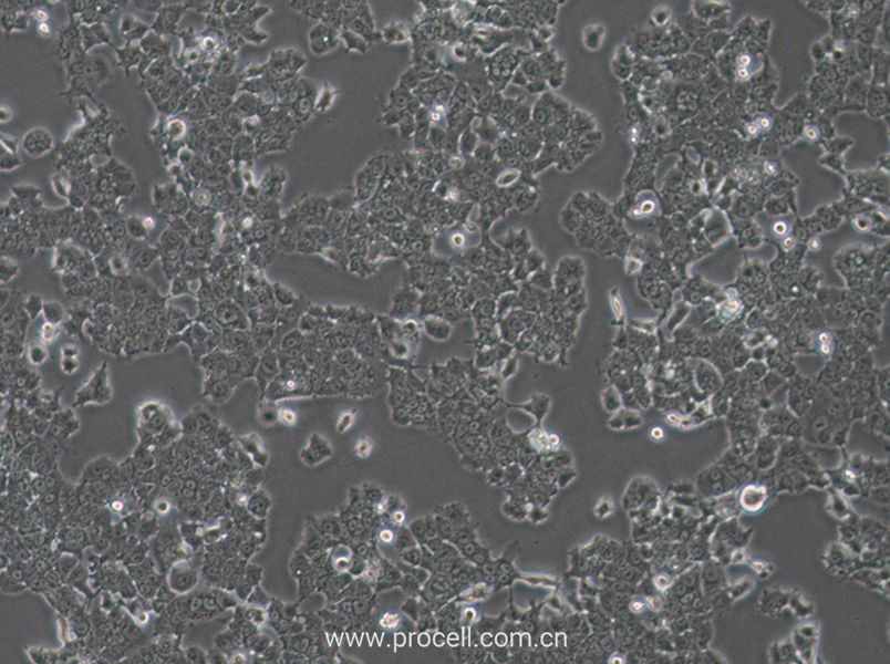 NCI-H1573 (人肺癌腺癌細(xì)胞) (STR鑒定正確)