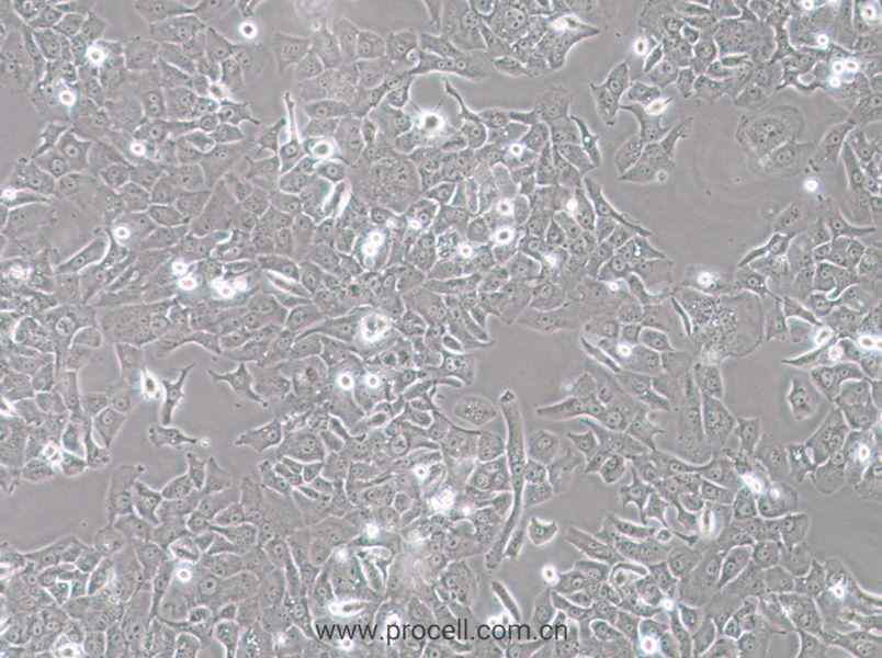 HCC4006 (人肺癌腺癌細(xì)胞) (STR鑒定正確)