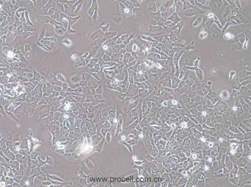 HCC4006 (人肺癌腺癌細(xì)胞) (STR鑒定正確)