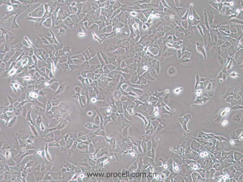 HCC4006 (人肺癌腺癌細(xì)胞) (STR鑒定正確)