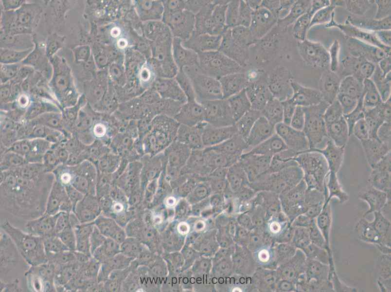 HCC4006 (人肺癌腺癌細(xì)胞) (STR鑒定正確)